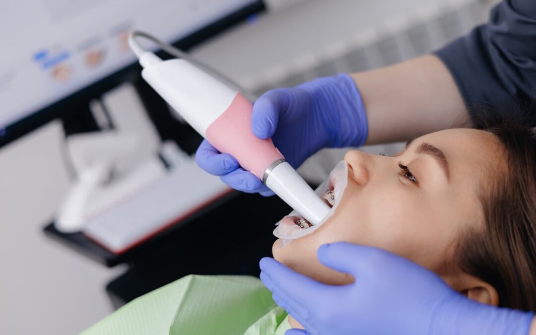 Ενδοστοματικός Σαρωτής (Intraoral Scanner)